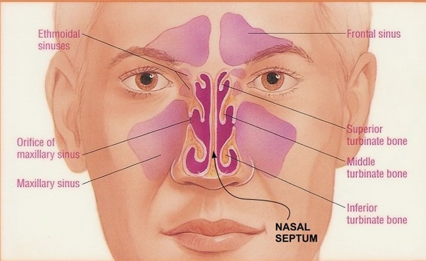 TREATMENT OF DEVIATED NOSE